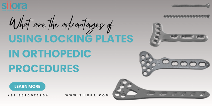 advantages of using locking plates