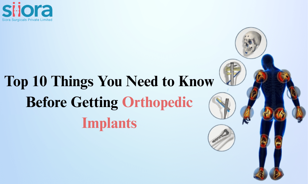 Top 10 Things You Need to Know Before Getting Orthopedic Implants