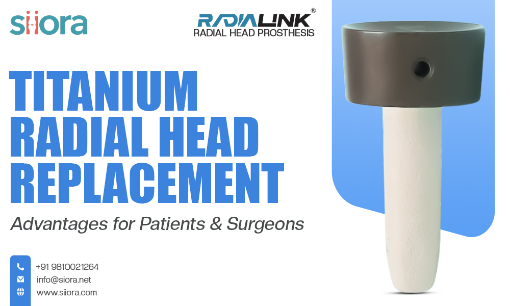 Titanium Radial Head Replacement